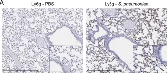 Fig.1.A showing Immunohistochemistry-paraffin in a Mus musculus (House mouse) sample from the publication: Regulation of neutrophilic inflammation by proteinase-activated receptor 1 during bacterial pulmonary infection.
