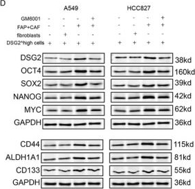 Fig.9.D showing Western Blotting in a Homo sapiens (Human) sample from the publication: DSG2+ Cancer Stem Cells Co-Located With FAP+ Myofibroblasts in the Tumor Boundary That Determines the Efficacy of Immunotherapy in Non-Small Cell Lung Cancer.