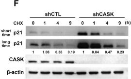 Fig.4.F showing Western Blotting from the publication: CASK promotes non-small cell lung cancer growth through coordinated regulation of EGFR expression, trafficking, and p21 expression.