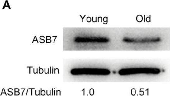 Fig.5.A showing Western Blotting in a Mus musculus (House mouse) sample from the publication: ASB7 Is a Novel Regulator of Cytoskeletal Organization During Oocyte Maturation.