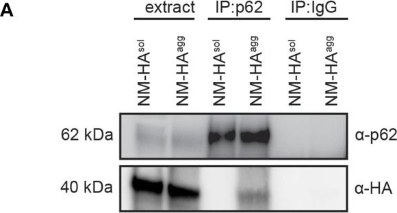 Fibril-induced glutamine-/asparagine-rich prions recruit stress granule proteins in mammalian cells.