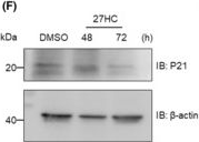 Fig.2.F showing Western Blotting in a Homo sapiens (Human) sample from the publication: 27-Hydroxycholesterol represses G9a expression via oestrogen receptor alpha in breast cancer.