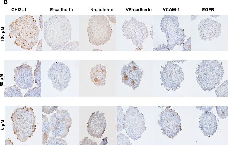 Fig.6.B showing Immunohistochemistry from the publication: Inhibition of CHI3L1 decreases N-cadherin and VCAM-1 levels in glioblastoma.
