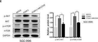 FoxK1 Antibody | Cell Signaling Technology