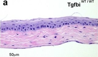 Fig.3.A showing Immunohistochemistry from the publication: Generation of mouse model of TGFBI-R124C corneal dystrophy using CRISPR/Cas9-mediated homology-directed repair.