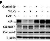 Fig.5.F showing Western Blotting from the publication: Targeting the Mitochondrial Chaperone TRAP1 Alleviates Vascular Pathologies in Ischemic Retinopathy.