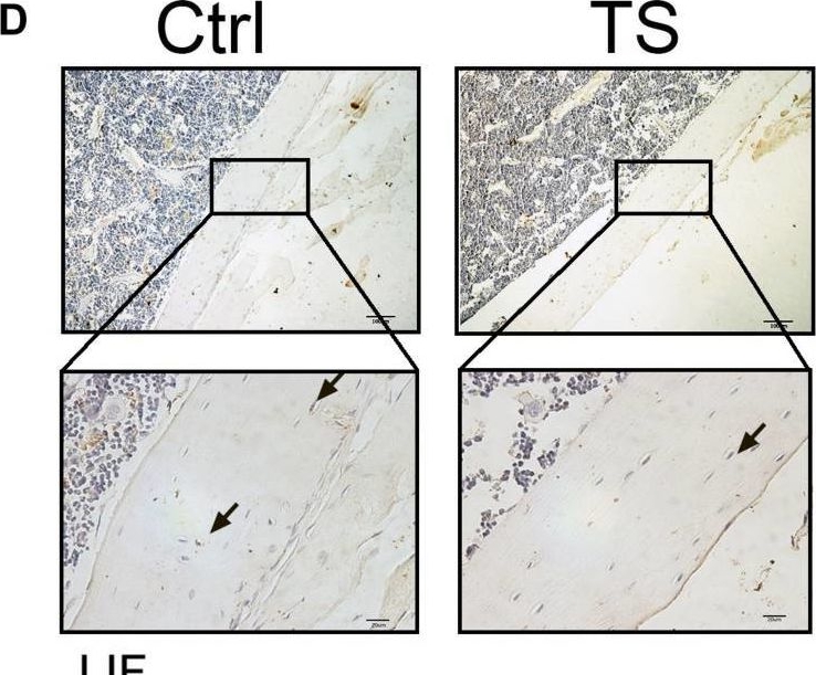 Fig.1.D showing Immunohistochemistry in a Mus musculus (House mouse) sample from the publication: Osteoblast and Osteoclast Activity Affect Bone Remodeling Upon Regulation by Mechanical Loading-Induced Leukemia Inhibitory Factor Expression in Osteocytes.