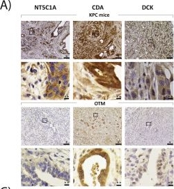 Fig.1.A showing Immunohistochemistry in a Mus musculus (House mouse) sample from the publication: Expression of gemcitabine metabolizing enzymes and stromal components reveal complexities of preclinical pancreatic cancer models for therapeutic testing.