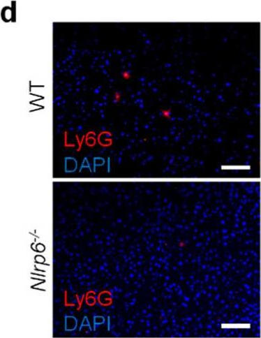 Fig.4.D showing Immunohistochemistry-immunofluorescence in a Mus musculus (House mouse) sample from the publication: NLRP6 Inflammasome Modulates Disease Progression in a Chronic-Plus-Binge Mouse Model of Alcoholic Liver Disease.
