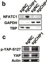 Fig.5.B showing Western Blotting in a Homo sapiens (Human) sample from the publication: Targeting the Calcineurin Homologous Protein 1 (CHP1)-Transmembrane Protein 87A (TMEM87A) mechanosensing complex: a druggable vulnerability in metastatic ovarian cancer.