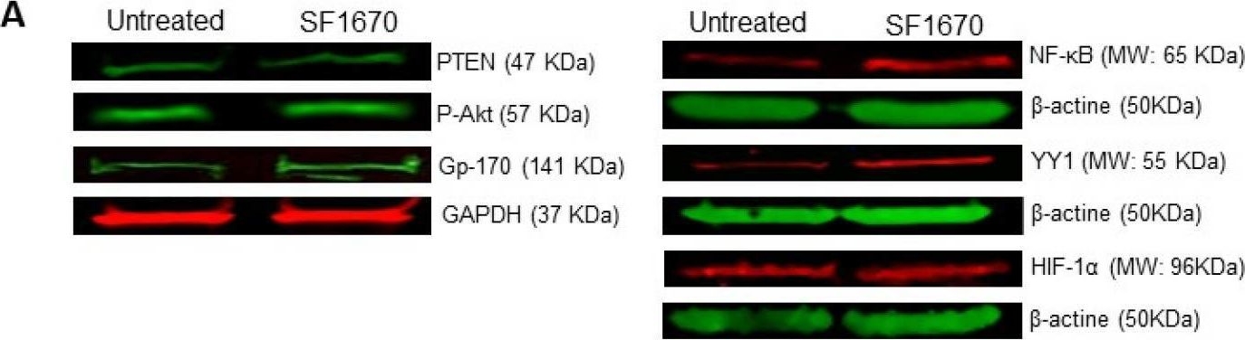 Fig.2.A showing Western Blotting in a Homo sapiens (Human) sample from the publication: The Role of PTEN in Chemoresistance Mediated by the HIF-1α/YY1 Axis in Pediatric Acute Lymphoblastic Leukemia.