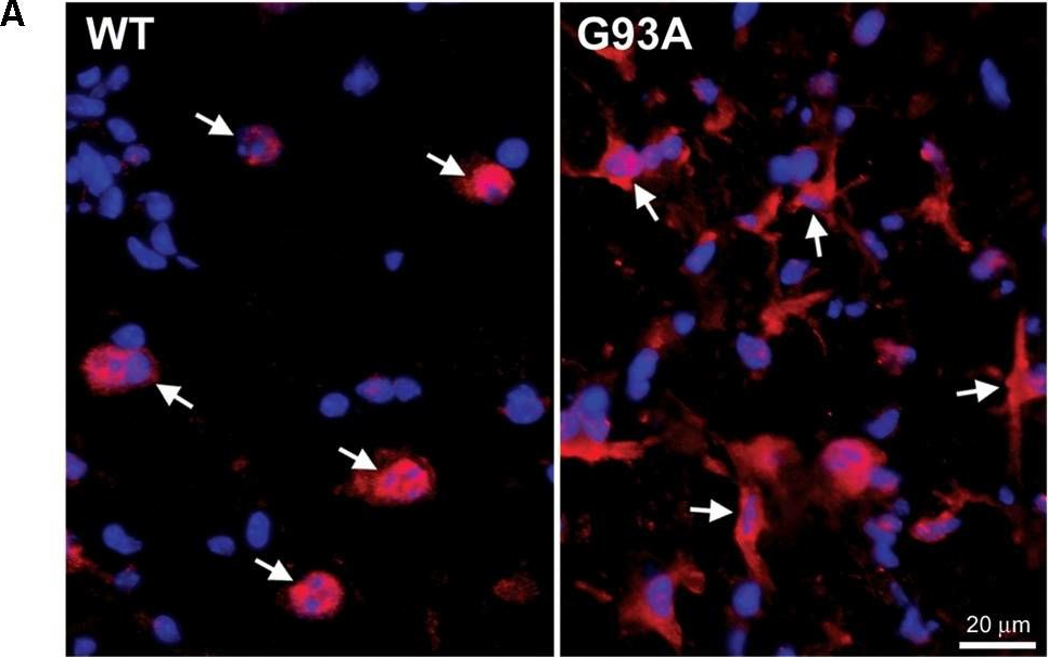 Fig.2.A showing Immunohistochemistry in a Mus musculus (House mouse) sample from the publication: The Bcl-2 Homology-3 Domain (BH3)-Only Proteins, Bid, DP5/Hrk, and BNip3L, Are Upregulated in Reactive Astrocytes of End-Stage Mutant SOD1 Mouse Spinal Cord.