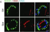 Fig.4.C showing Immunocytochemistry-immunofluorescence in a Homo sapiens (Human) sample from the publication: Chemical screen identifies a geroprotective role of quercetin in premature aging.