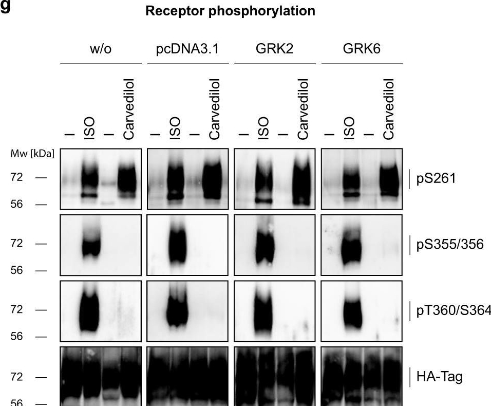 Fig.6.G showing Western Blotting in a Homo sapiens (Human) sample from the publication: How Carvedilol activates β2-adrenoceptors.