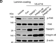 Fig.5.D showing Western Blotting from the publication: TM4SF1 promotes esophageal squamous cell carcinoma metastasis by interacting with integrin α6.