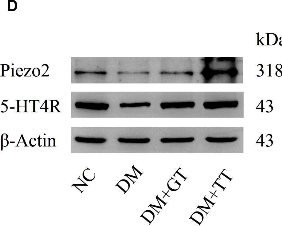 Fig.8.D showing Western Blotting from the publication: Long-term tuina can inhibit the occurrence of gastroparesis by protecting gastrointestinal function in diabetic rats.