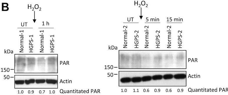 Fig.7.B showing Western Blotting from the publication: Lamin A/C impairments cause mitochondrial dysfunction by attenuating PGC1α and the NAMPT-NAD+ pathway.