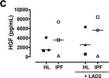 Fig.2.C showing Enzyme-linked immunosorbent assay from the publication: Crosstalk between Mast Cells and Lung Fibroblasts Is Modified by Alveolar Extracellular Matrix and Influences Epithelial Migration.
