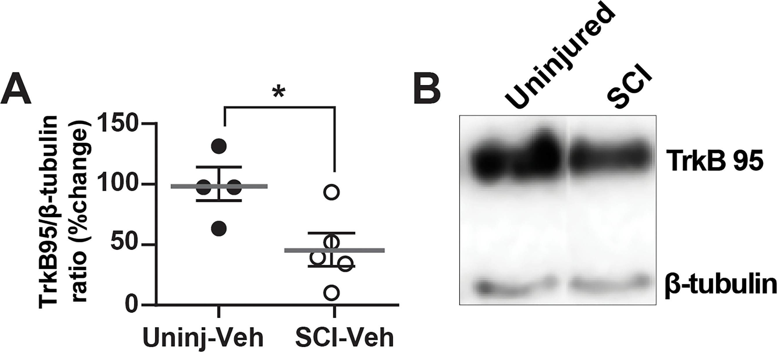 Fig.7.A showing Western Blotting from the publication: TrkB Agonist (7,8-DHF)-Induced Responses in Dorsal Root Ganglia Neurons Are Decreased after Spinal Cord Injury: Implication for Peripheral Pain Mechanisms.