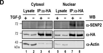 Fig.1.D showing Western Blotting in a Homo sapiens (Human) sample from the publication: The role of sentrin-specific protease 2 substrate recognition in TGF-β-induced tumorigenesis.