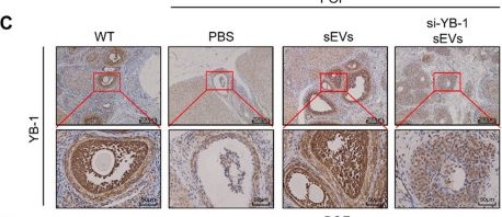 Fig.6.C showing Immunohistochemistry from the publication: Exosomal YB-1 facilitates ovarian restoration by MALAT1/miR-211-5p/FOXO3 axis.