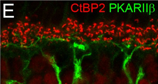 Fig.1.E showing Immunohistochemistry-immunofluorescence in a Mus musculus (House mouse) sample from the publication: Dendritic stratification differs among retinal OFF bipolar cell types in the absence of rod photoreceptors.
