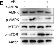Fig.9.E showing Western Blotting from the publication: Vespakinin-M delineates an AMPK/mTOR-arginine-TCA cycle axis to act as an immunometabolic switch in post-stroke microglia.