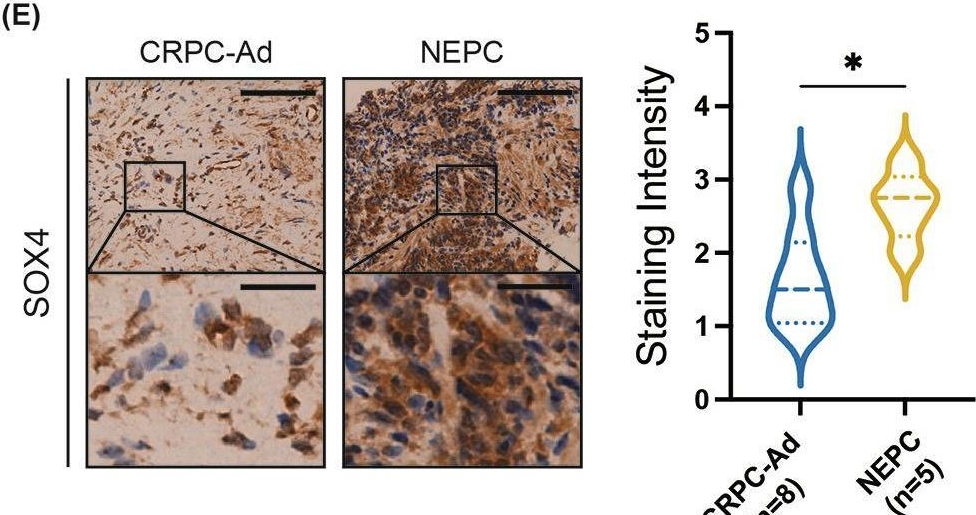 Fig.1.E showing Immunohistochemistry from the publication: Targeting SOX4/PCK2 signaling suppresses neuroendocrine trans-differentiation of castration-resistant prostate cancer.