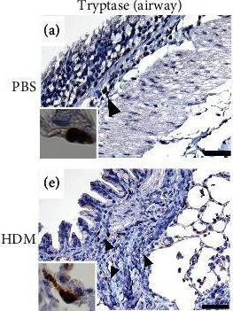 Fig.6.A showing Immunohistochemistry from the publication: House Dust Mite and Cat Dander Extract Induce Asthma-Like Histopathology with an Increase of Mucosal Mast Cells in a Guinea Pig Model.