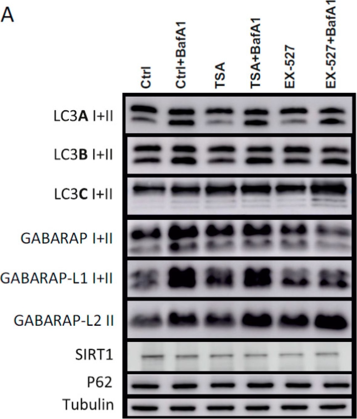 Novel Insights into the Cellular Localization and Regulation of the Autophagosomal Proteins LC3A, LC3B and LC3C.