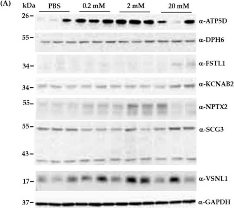 Fig.2.A showing Western Blotting in a Homo sapiens (Human) sample from the publication: Differential Expression of Multiple Disease-Related Protein Groups Induced by Valproic Acid in Human SH-SY5Y Neuroblastoma Cells.