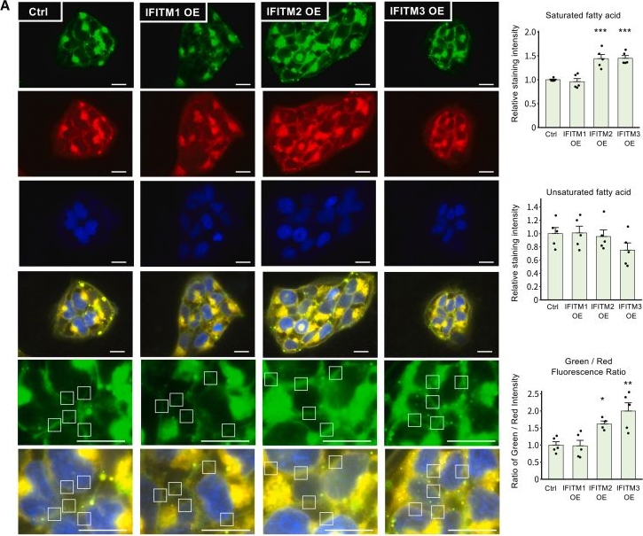 Fig.6.A showing Immunocytochemistry-immunofluorescence in a Homo sapiens (Human) sample from the publication: DHODH regulates trophoblast fusion via IFITM-reduced plasma membrane fluidity: Implications for hypertensive disorders of pregnancy.