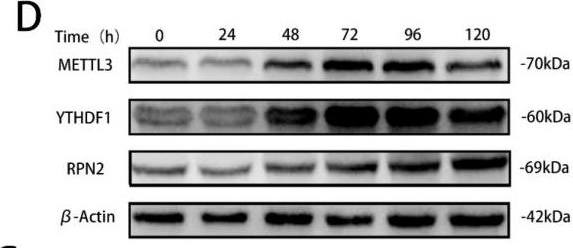 Fig.4.D showing Western Blotting in a Homo sapiens (Human) sample from the publication: YTHDF1 Promotes Bladder Cancer Cell Proliferation via the METTL3/YTHDF1-RPN2-PI3K/AKT/mTOR Axis.
