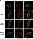 Fig.6.B showing Immunocytochemistry-immunofluorescence from the publication: Structural basis for itraconazole-mediated NPC1 inhibition.