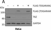 Fig.9.A showing Western Blotting in a Homo sapiens (Human) sample from the publication: The Hippo pathway transcription factors YAP and TAZ play HPV-type dependent roles in cervical cancer.