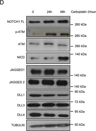 Fig.1.D showing Western Blotting in a Homo sapiens (Human) sample from the publication: NOTCH1 intracellular domain stabilization by MDM2 plays a major role in NSCLC response to platinum.