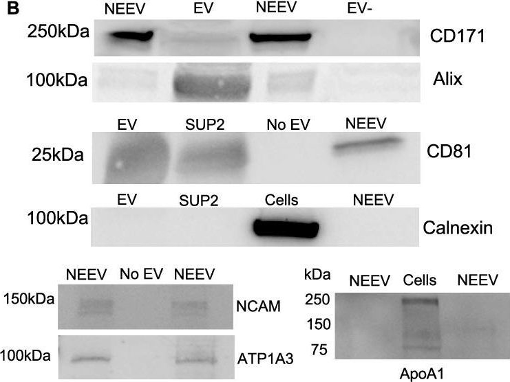 Fig.1.B showing Western Blotting in a Homo sapiens (Human) sample from the publication: Exploring the role of neuronal-enriched extracellular vesicle miR-93 and interoception in major depressive disorder.