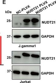 Fig.8.E showing Western Blotting in a Homo sapiens (Human) sample from the publication: NUDT21 Drives T-Cell Acute Lymphoblastic Leukemia Through Dual Regulation of Alternative Polyadenylation and Transcriptional Activation.