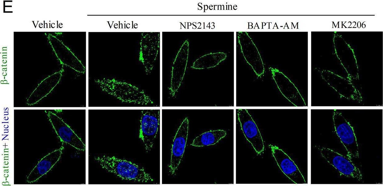 Fig.4.E showing Immunocytochemistry-immunofluorescence from the publication: Elevation of spermine remodels immunosuppressive microenvironment through driving the modification of PD-L1 in hepatocellular carcinoma.