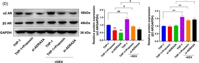 Fig.2.D showing Western Blotting in a Homo sapiens (Human) sample from the publication: Dexmedetomidine activates the PKA/CREB pathway and inhibits proinflammatory factor expression through β2 adrenergic receptors.