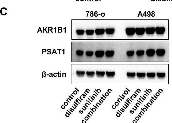 Fig.5.C showing Western Blotting in a Mus musculus (House mouse) sample from the publication: Targeting NPL4 via drug repositioning using disulfiram for the treatment of clear cell renal cell carcinoma.