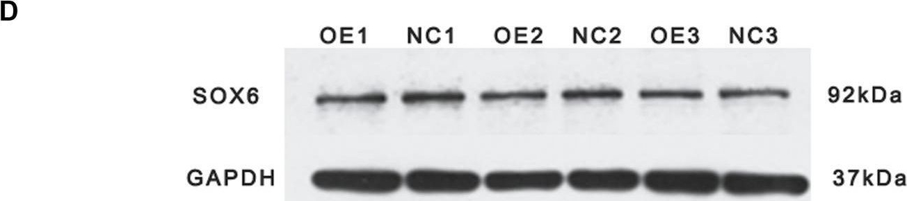 Fig.4.D showing Western Blotting from the publication: Transcriptome sequencing analysis of the role of miR-499-5p and SOX6 in chicken skeletal myofiber specification.