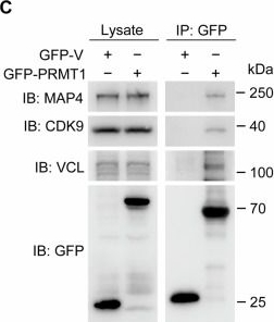Fig.7.C showing Western Blotting in a Mus musculus (House mouse) sample from the publication: Protein arginine methyltransferase 1 stimulates basal cell proliferation and migration to maintain corneal epithelial homeostasis.