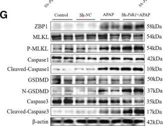 Fig.10.G showing Western Blotting in a Mus musculus (House mouse) sample from the publication: Identification and validation of key PANoptosis-related genes via integrative machine learning and single-cell sequencing in AILI.