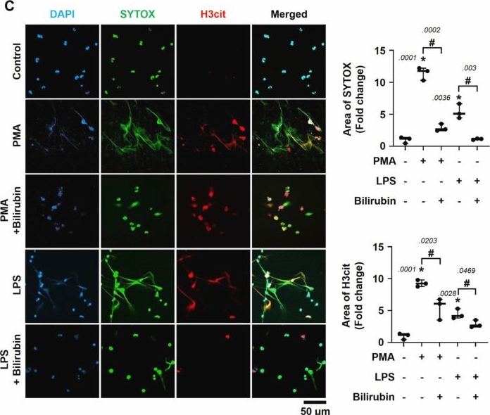 Fig.3.C showing Immunocytochemistry-immunofluorescence from the publication: Bilirubin reduces mortality in sepsis models by inhibiting NOX2-mediated formation of neutrophil extracellular traps.