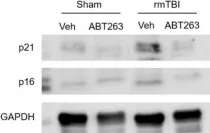 Fig.7.A showing Western Blotting in a Mus musculus (House mouse) sample from the publication: Neurons and glial cells acquire a senescent signature after repeated mild traumatic brain injury in a sex-dependent manner.