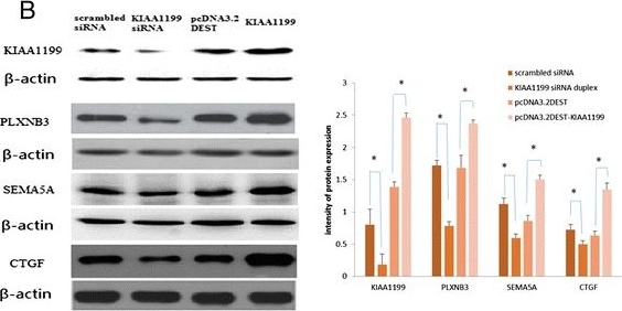 Fig.5.B showing Western Blotting in a Homo sapiens (Human) sample from the publication: KIAA1199 as a potential diagnostic biomarker of rheumatoid arthritis related to angiogenesis.