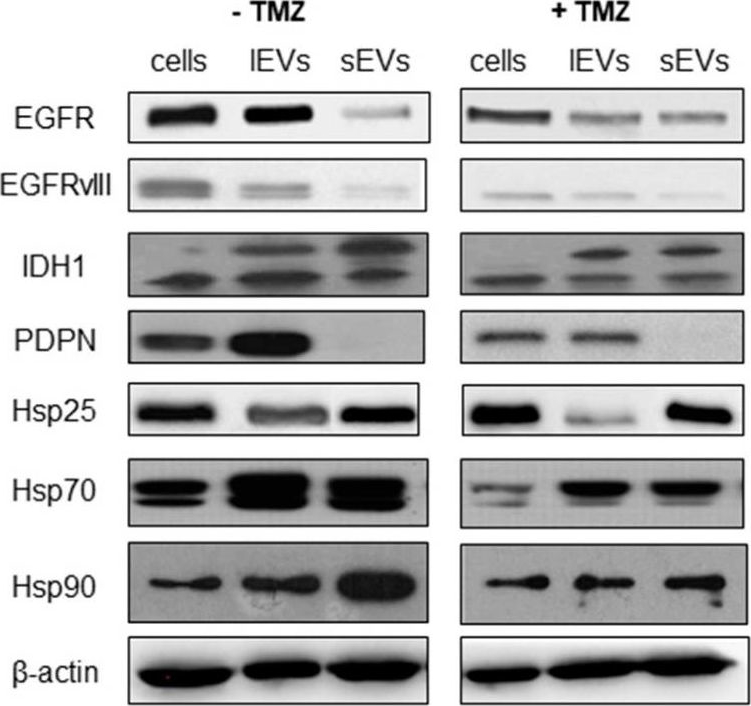 Fig.3.A showing Western Blotting in a Homo sapiens (Human) sample from the publication: Molecular Characterization of Temozolomide-Treated and Non Temozolomide-Treated Glioblastoma Cells Released Extracellular Vesicles and Their Role in the Macrophage Response.