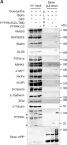 Fig.4.A showing Western Blotting from the publication: The homophilic receptor PTPRK selectively dephosphorylates multiple junctional regulators to promote cell-cell adhesion.