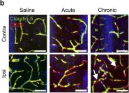 Fig.2.B showing Immunohistochemistry-immunofluorescence in a Mus musculus (House mouse) sample from the publication: Microvascular stabilization via blood-brain barrier regulation prevents seizure activity.
